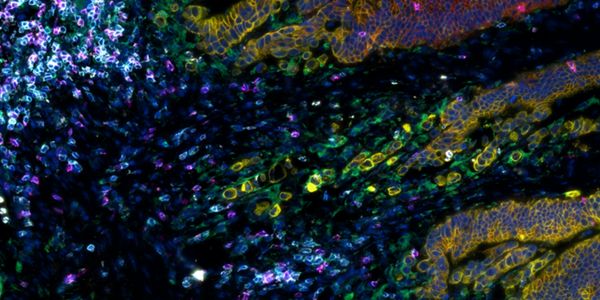Including Spatial Proteomics in your research - why and how