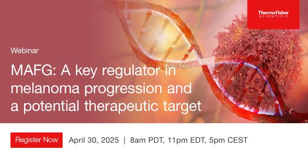 MAFG: A key regulator in melanoma progression and a potential therapeutic target