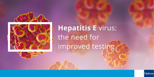 Hepatitis E virus: the need for improved testing