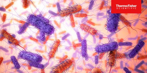 Navigating the Molecular Frontier: From Poo to Precision - A Journey in GI Test Implementation