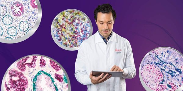 Tips, Tricks, and Optimization: A User's Guide to BOND RX and Chromogenic Multiplexing in Research Applications