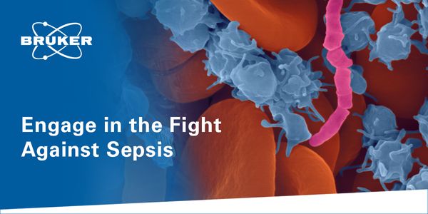 Current Landscape of Blood Culture Diagnostic Methods