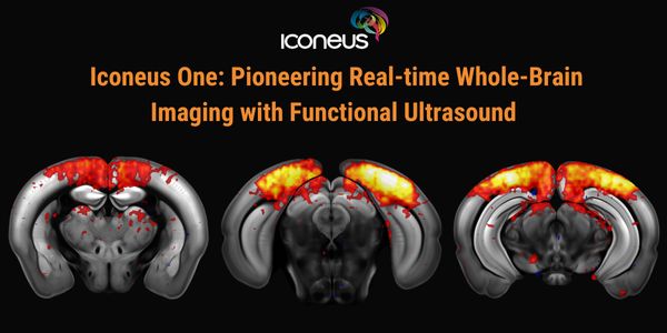 Iconeus One: Pioneering Real-time Whole-Brain Imaging with Functional Ultrasound