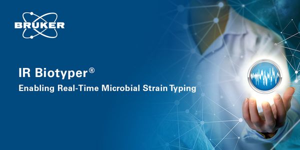 IR Biotyper® - New insights into microorganism strain- and serotyping by FT-IR spectroscopy