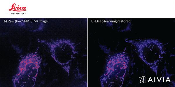 Introduction to AI Image Analysis in Microscopy