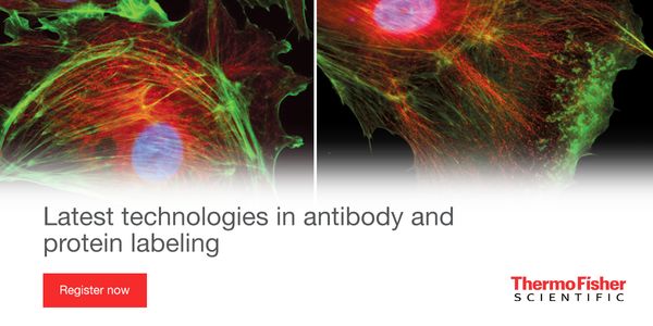 Latest technologies in antibody and protein labeling