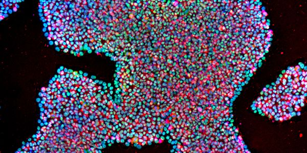 Pluripotent stem cells:  How to raise the quality of your PSC culture