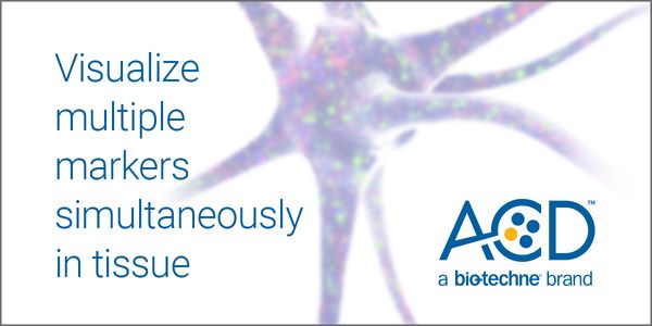 Examination of Microglia at Single Cell Resolution in Health and Disease