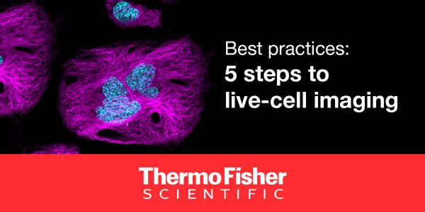 Best practices: 5 steps to live-cell imaging