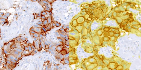 Demystifying machine learning: driving image analysis using your biological knowledge