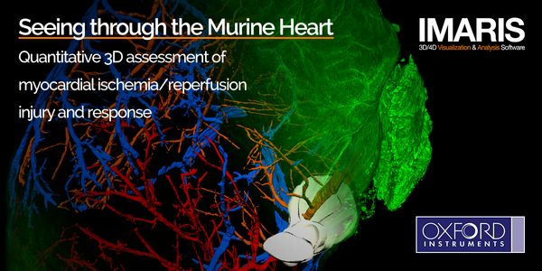 Seeing through the murine heart - quantitative 3D assessment of myocardial ischemia/reperfusion injury and response