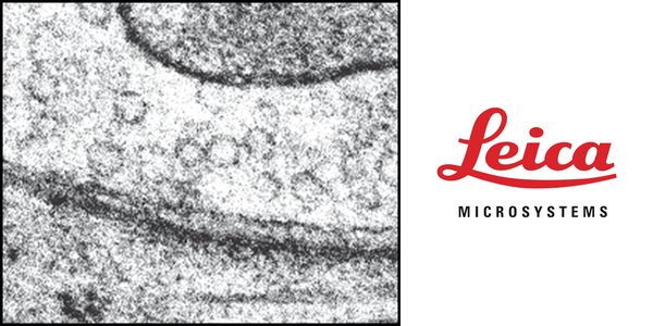 Time-resolved electron microscopy: synaptic ultrastructure millisecond by millisecond with high-pressure freezing