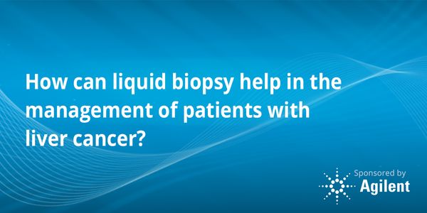 How can liquid biopsy help in the management of patients with liver cancer?