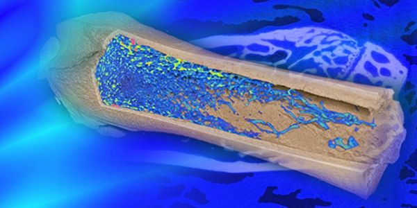 Using Micro-CT Imaging for the Phenotyping and Analysis of Bone Architecture