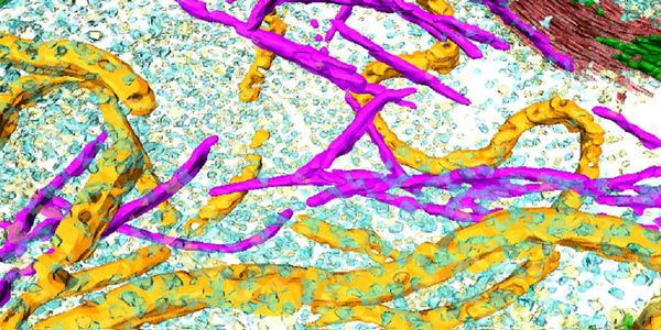 Correlative (Cryo-)Microscopy for Cell Biology