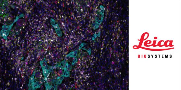 Automated Multiplex Immunofluorescence