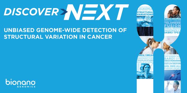 Bionano Genome Imaging unravels complex structural rearrangements induced by replication stress in liver cancer