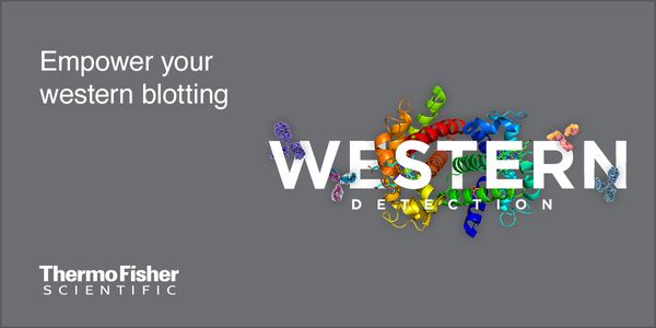 Detecting low-abundance proteins in a western blot: Overcoming challenges for improved signal-to-noise of low-expressing and precious sample targets