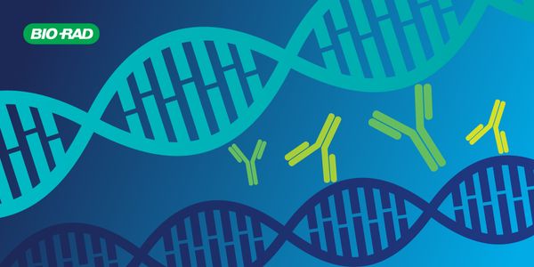 Facing the Challenges of Anti-dsDNA Antibody Testing