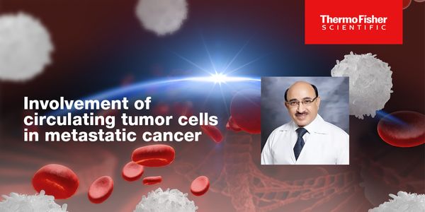 Enumeration and Molecular Profiling of Circulating Tumor Cells for Diagnosis and Therapeutic Monitoring of Metastatic Cancer