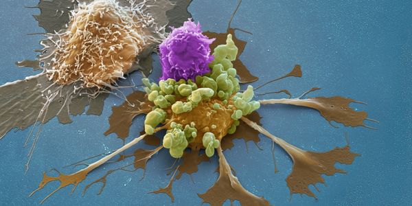 Miltenyi Biotec's latest solutions to improve your CAR T cell research