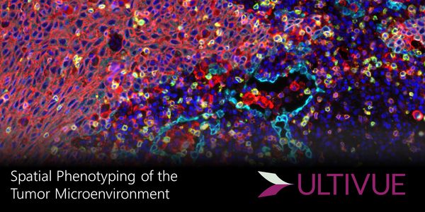 Advanced Phenotyping of the Tumor Immune Microenvironment