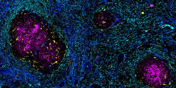 Accelerating discovery together: Community resources for multiplexed imaging of diverse tissues