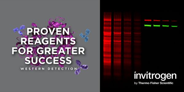 A Novel Method for Quantitative  Western Blotting that Eliminates Errors from the Use of  Housekeeping Proteins