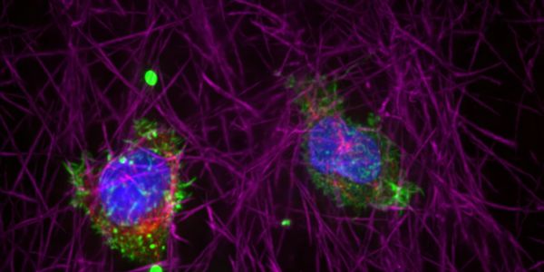 Stretching the Limits of Microscopy Imaging with Deep Learning