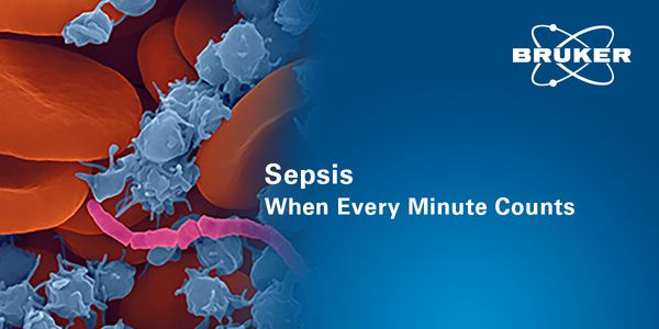 Utilizing rapid diagnostics and new methods to quickly diagnose sepsis