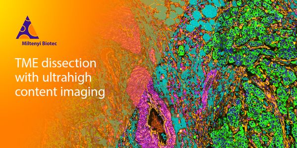 Automated surveillance for deep characterization of the tumor microenvironment using ultra-high content imaging