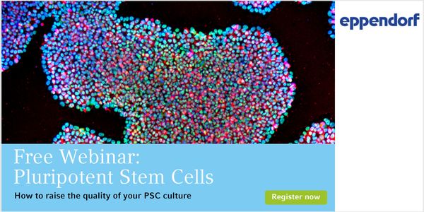 Pluripotent stem cells:  How to raise the quality of your PSC culture