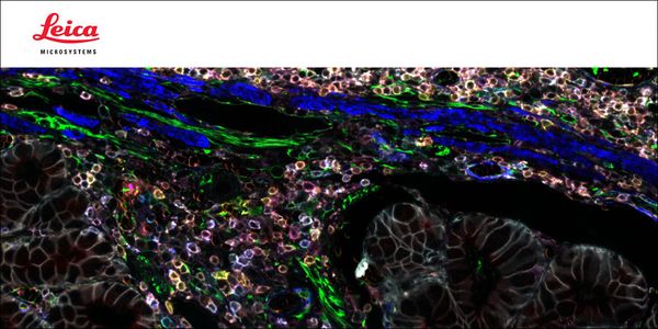 Study design: How and when to use multiplexed immunofluorescence imaging in your research