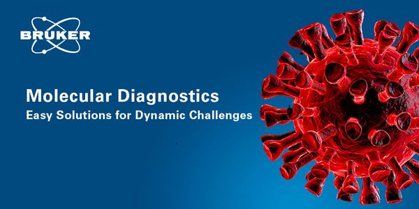 SARS-CoV-2 diagnostic workflow with the GenoXtract® fleXT and the FluoroCycler® XT