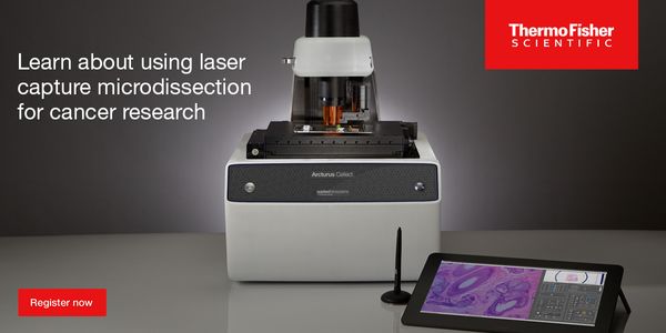 How to Leverage Laser Capture Microdissection Technology for Advanced Oncology Research