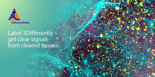 Label 3Differently - how 3D-IF-validated antibodies provide clear signals from cleared tissues in large-scale 3D imaging