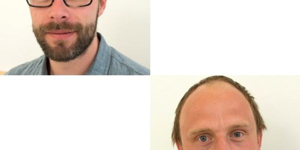 The dynamics of β-amyloid plaque genesis - an in vivo study in transgenic mice of Alzheimer's disease