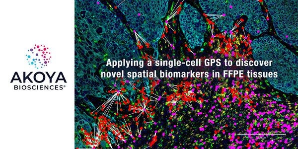 Applying a single-cell GPS to discover novel spatial biomarkers in FFPE tissues