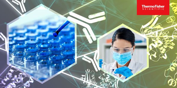 Streamline your path from immunodiagnostic development to commercialization