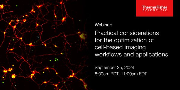 Practical considerations for the optimization of cell-based imaging workflows and applications