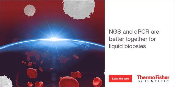 Impact of liquid biopsy in advanced HER2+ breast cancer tumors: a follow-up study