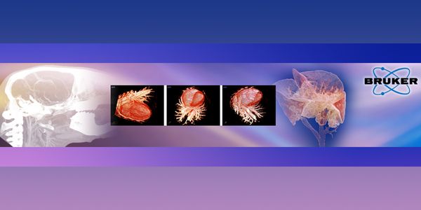 How microCT Can Provide Insight into Dynamic Disease Processes