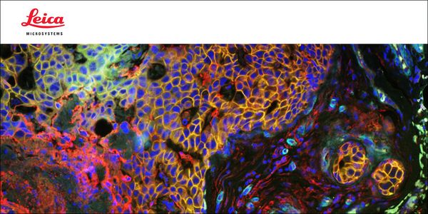 Cell DIVE: a robust platform for multiplexed whole slide imaging and single-cell analysis