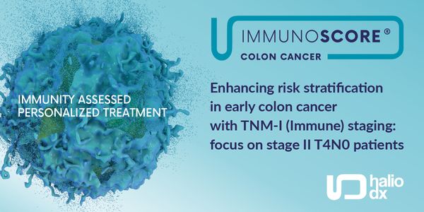 Enhancing risk stratification in early colon cancer with TNM-I (Immune) staging: focus on stage II T4N0 patients