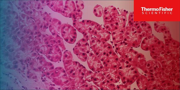 Scalable 2D and 3D human hepatocyte platforms for target validation and compound screening in early drug discovery pipelines of liver diseases