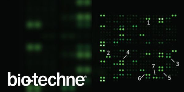 Vaccines for the treatment and prevention of cancer