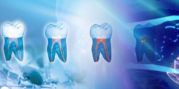 Endodontic applications of microcomputed tomography for studying root canals