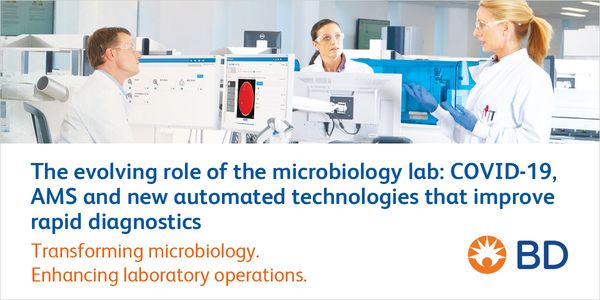 The evolving role of the microbiology lab: COVID-19, AMS and new automated technologies that improve rapid diagnostics