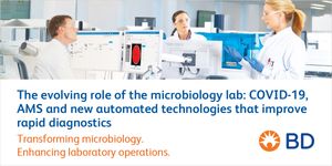 The evolving role of the microbiology lab: COVID-19, AMS and new automated technologies that improve rapid diagnostics