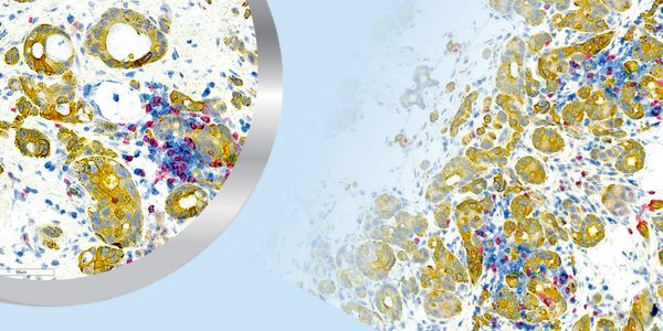 UltraPlex Multiplex Technology: Tagging Technology for Mouse and Human Multiplexing